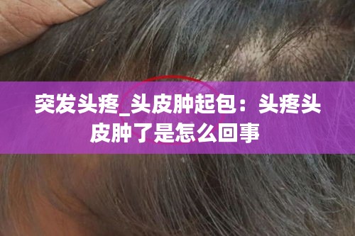 突发头疼_头皮肿起包：头疼头皮肿了是怎么回事 