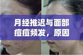 月经推迟与面部痘痘频发，原因解析与应对方法探讨