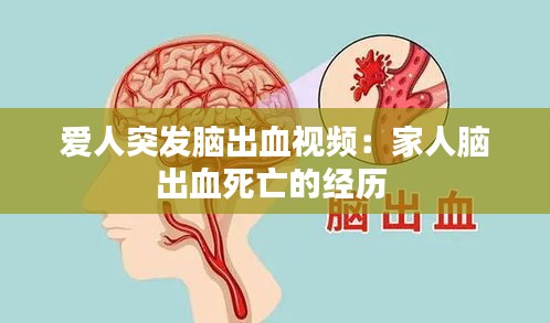 爱人突发脑出血视频：家人脑出血死亡的经历 