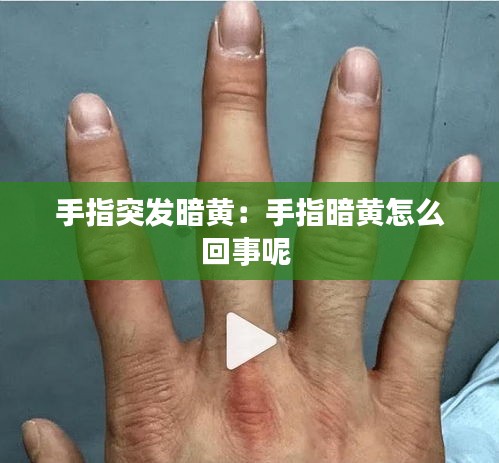 手指突发暗黄：手指暗黄怎么回事呢 