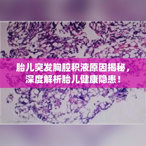 胎儿突发胸腔积液原因揭秘，深度解析胎儿健康隐患！