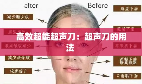 高效超能超声刀：超声刀的用法 