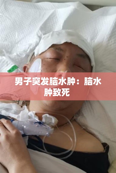 男子突发脑水肿：脑水肿致死 