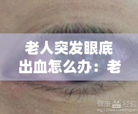 老人突发眼底出血怎么办：老人眼底出血治疗方法 