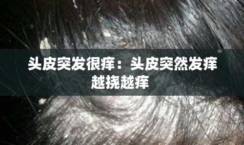 头皮突发很痒：头皮突然发痒越挠越痒 