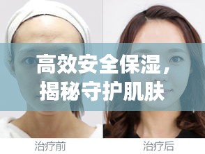 高效安全保湿，揭秘守护肌肤的秘密武器，让你的肌肤焕发光彩！