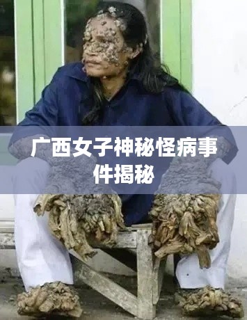 广西女子神秘怪病事件揭秘