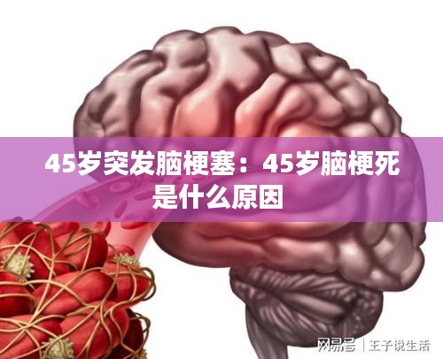 45岁突发脑梗塞：45岁脑梗死是什么原因 