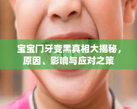 宝宝门牙变黑真相大揭秘，原因、影响与应对之策