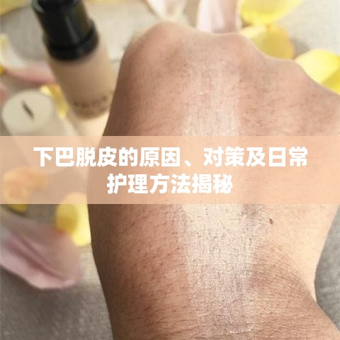 下巴脱皮的原因、对策及日常护理方法揭秘