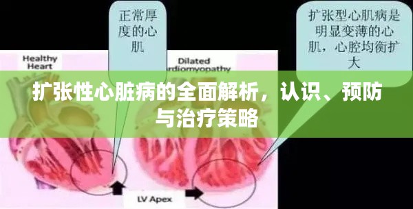 扩张性心脏病的全面解析，认识、预防与治疗策略