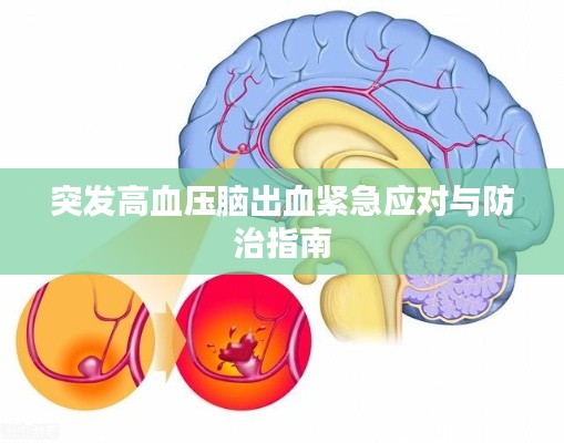 突发高血压脑出血紧急应对与防治指南