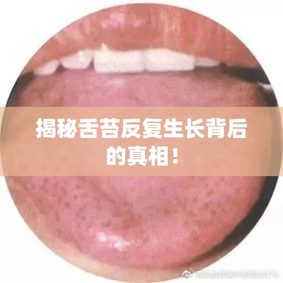 揭秘舌苔反复生长背后的真相！
