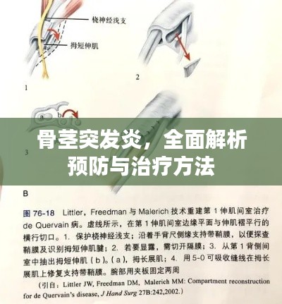 骨茎突发炎，全面解析预防与治疗方法